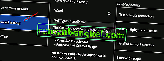 הגדרות רשת מתקדמות של Xbox One