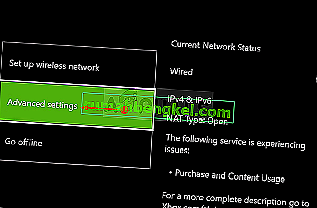 Xbox Oneの詳細ネットワーク設定